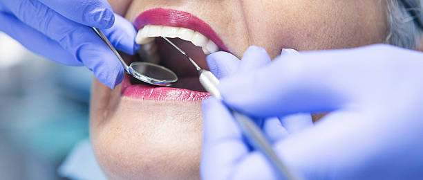 Best Emergency Wisdom Tooth Extraction in Ellwood City, PA